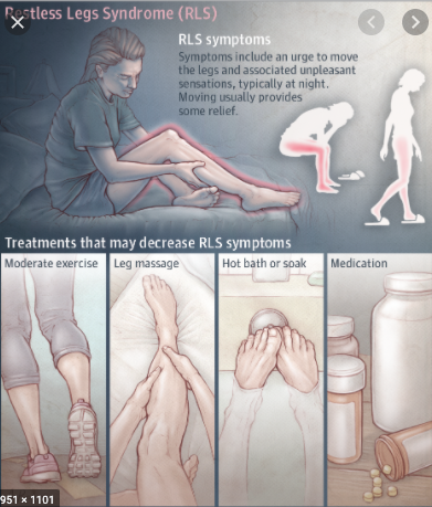 Quieting Restless Leg Syndrome: Caregiver Tips