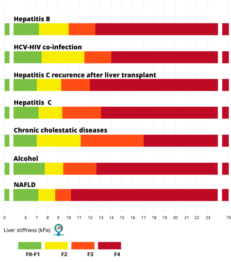 Fibroscan Cirrhosis Care